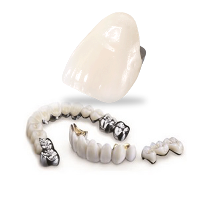 RĂNG SỨ CHROME COBALT & TITAN